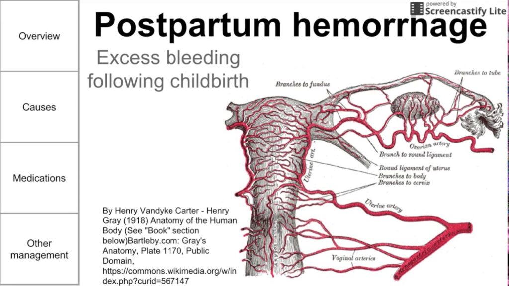 postpartum-hemorrhage-prevention-and-treatment-aafp