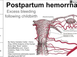 What Causes Postpartum Hemorrhage